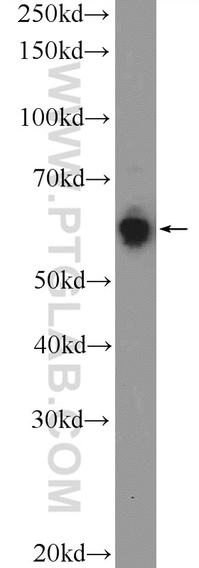 Western Blot (WB) analysis of HeLa cells using KLHL21 Polyclonal antibody (16952-1-AP)