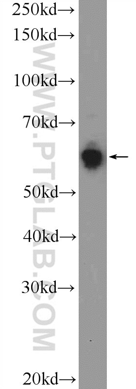 Western Blot (WB) analysis of HeLa cells using KLHL21 Polyclonal antibody (16952-1-AP)