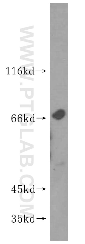 Western Blot (WB) analysis of A431 cells using KLHL21 Polyclonal antibody (16952-1-AP)