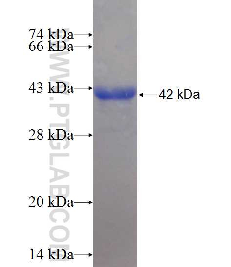 KLHL21 fusion protein Ag10845 SDS-PAGE