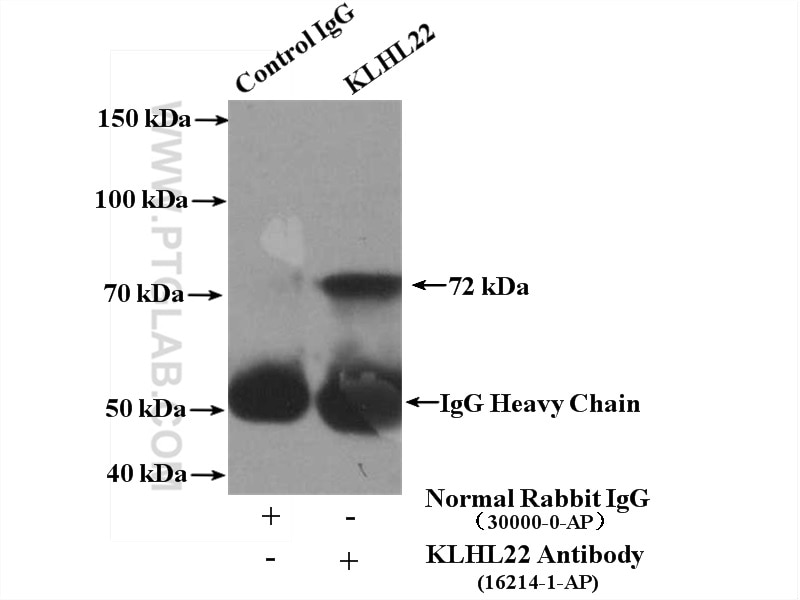 Immunoprecipitation (IP) experiment of PC-3 cells using KLHL22 Polyclonal antibody (16214-1-AP)