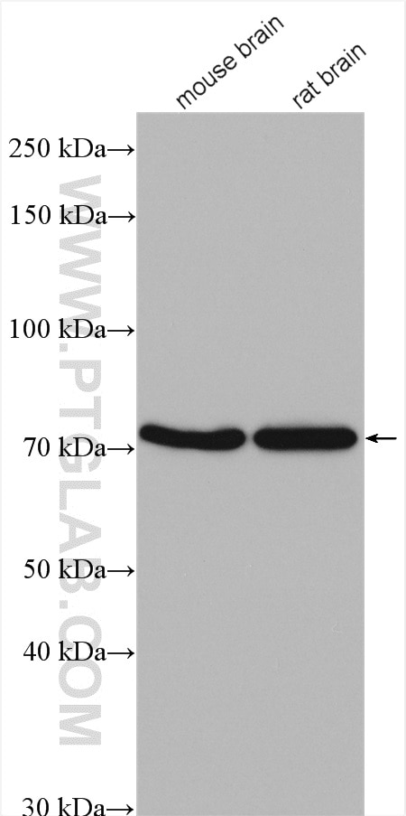 Western Blot (WB) analysis of various lysates using KLHL22 Polyclonal antibody (16214-1-AP)