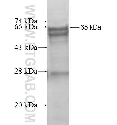 KLHL22 fusion protein Ag9212 SDS-PAGE