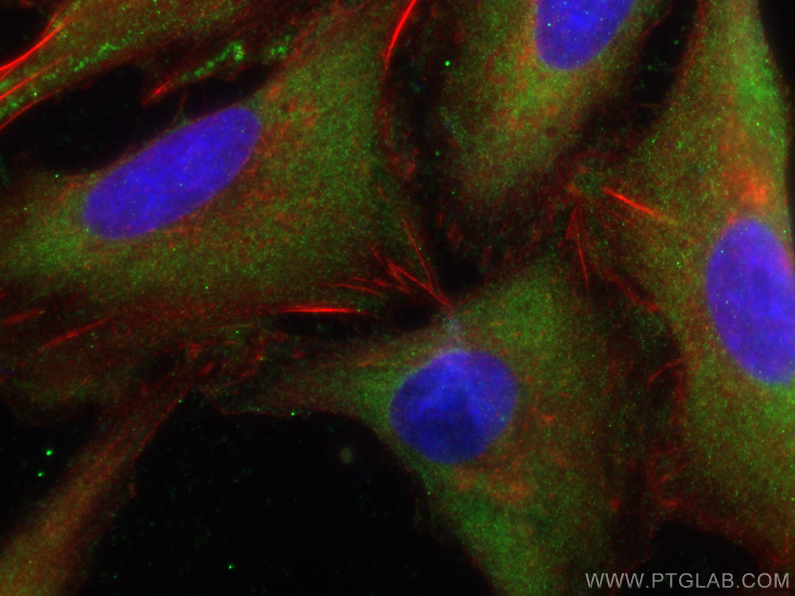 Immunofluorescence (IF) / fluorescent staining of A549 cells using KLHL25 Polyclonal antibody (27482-1-AP)