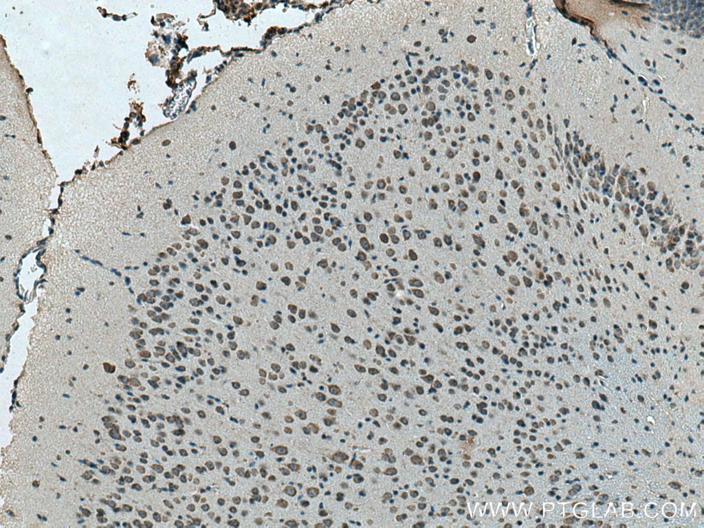 Immunohistochemistry (IHC) staining of mouse brain tissue using KLHL25 Polyclonal antibody (27482-1-AP)