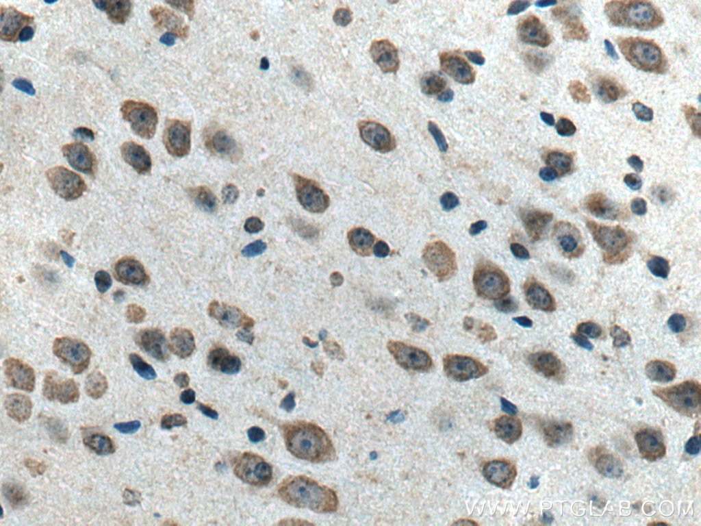 Immunohistochemistry (IHC) staining of mouse brain tissue using KLHL25 Polyclonal antibody (27482-1-AP)