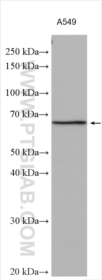 Western Blot (WB) analysis of various lysates using KLHL25 Polyclonal antibody (27482-1-AP)