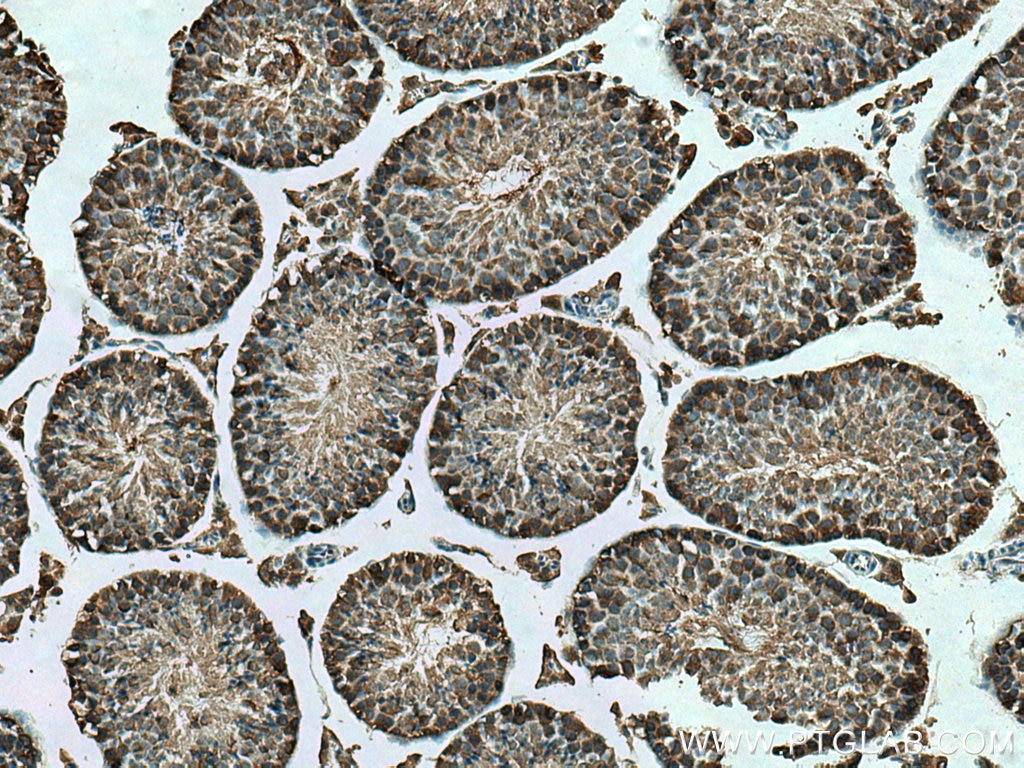 Immunohistochemistry (IHC) staining of mouse testis tissue using KLHL25 Monoclonal antibody (67774-1-Ig)