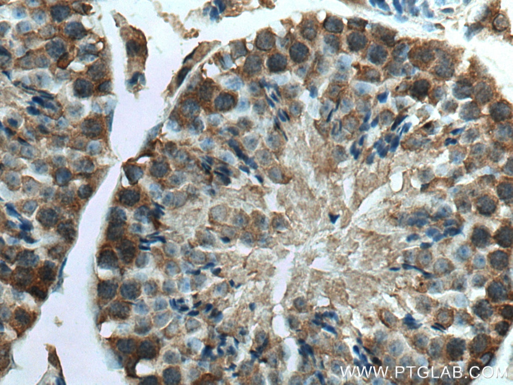 Immunohistochemistry (IHC) staining of mouse testis tissue using KLHL25 Monoclonal antibody (67774-1-Ig)