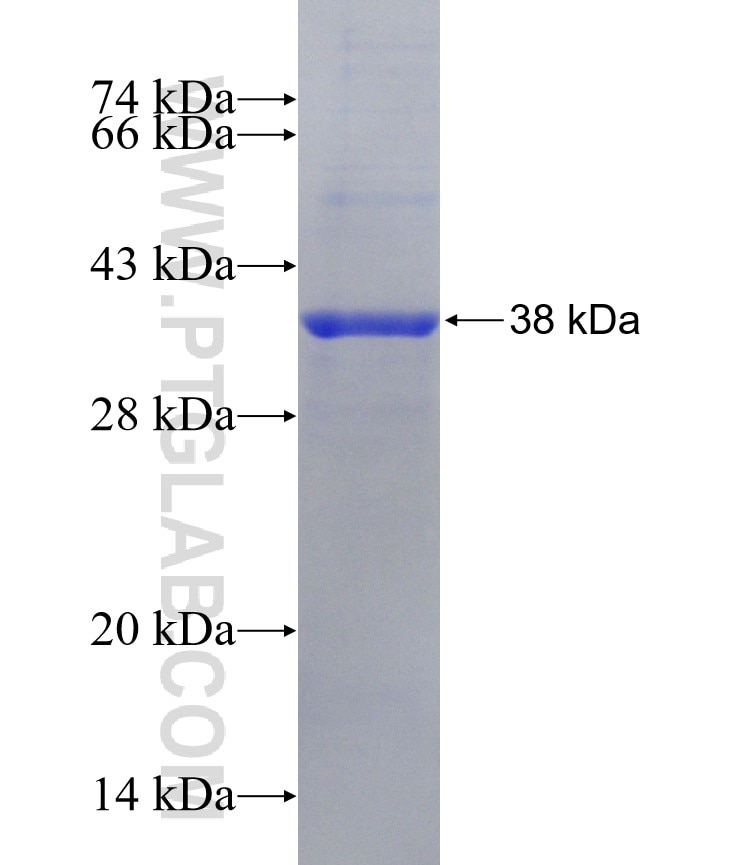 KLHL25 fusion protein Ag25765 SDS-PAGE