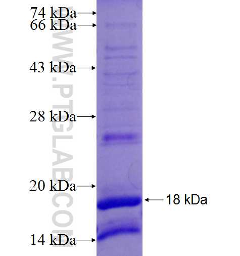 KLHL25 fusion protein Ag27037 SDS-PAGE