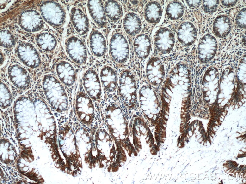 Immunohistochemistry (IHC) staining of human colon tissue using KLHL28 Polyclonal antibody (25224-1-AP)
