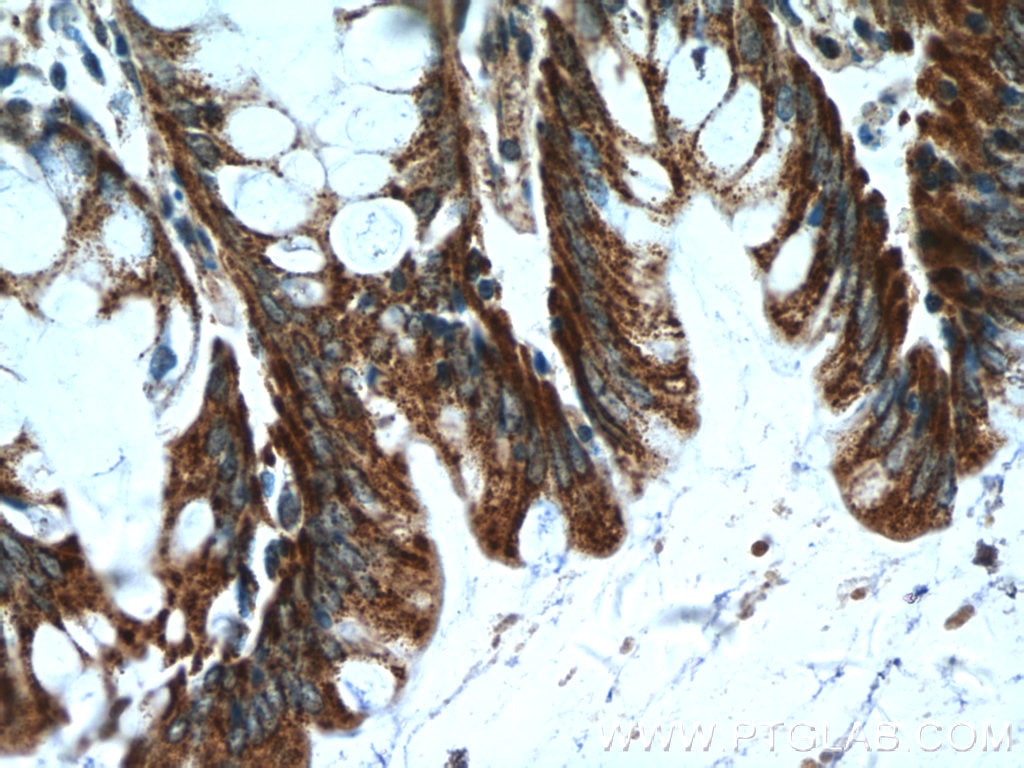 Immunohistochemistry (IHC) staining of human colon tissue using KLHL28 Polyclonal antibody (25224-1-AP)