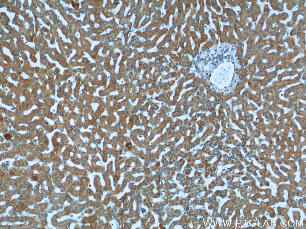 Immunohistochemistry (IHC) staining of human liver tissue using KLHL28 Polyclonal antibody (25224-1-AP)