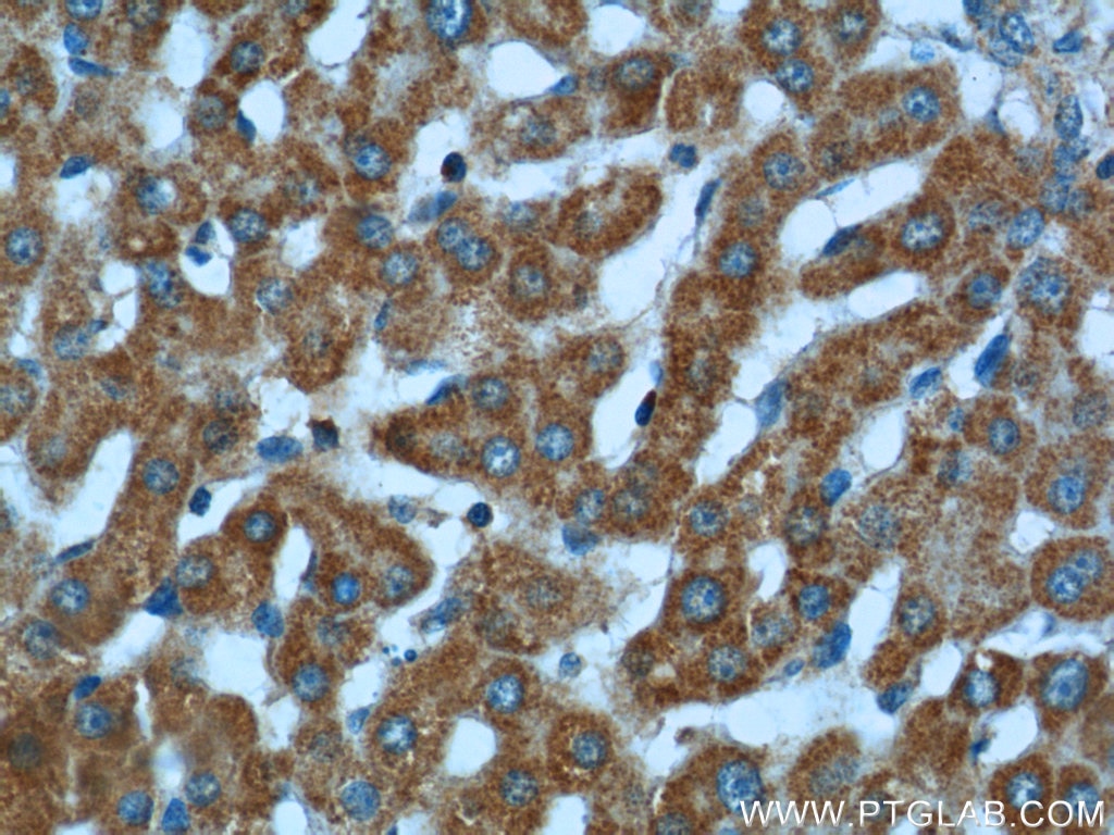 Immunohistochemistry (IHC) staining of human liver tissue using KLHL28 Polyclonal antibody (25224-1-AP)