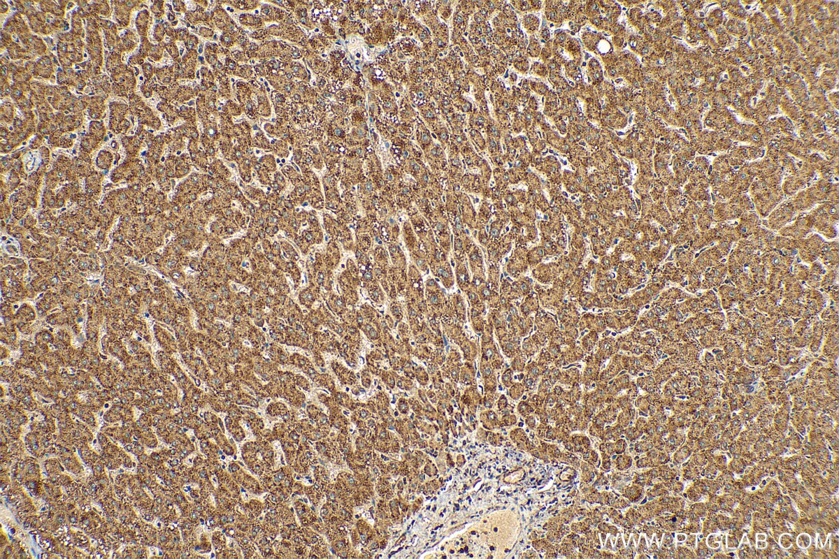 Immunohistochemistry (IHC) staining of human liver tissue using KLHL28 Polyclonal antibody (25224-1-AP)