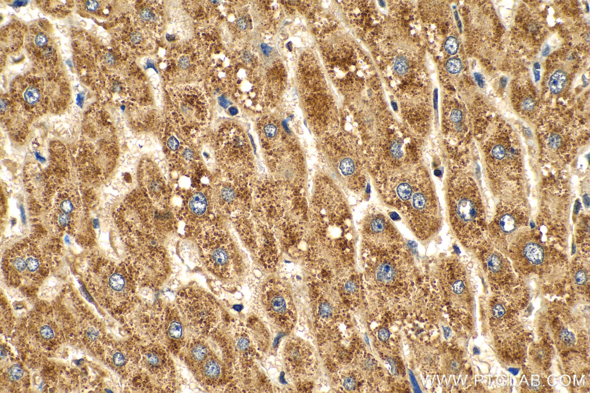 Immunohistochemistry (IHC) staining of human liver tissue using KLHL28 Polyclonal antibody (25224-1-AP)