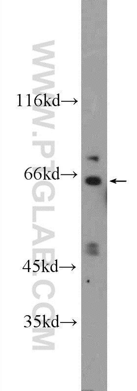 Western Blot (WB) analysis of Jurkat cells using KLHL28 Polyclonal antibody (25224-1-AP)