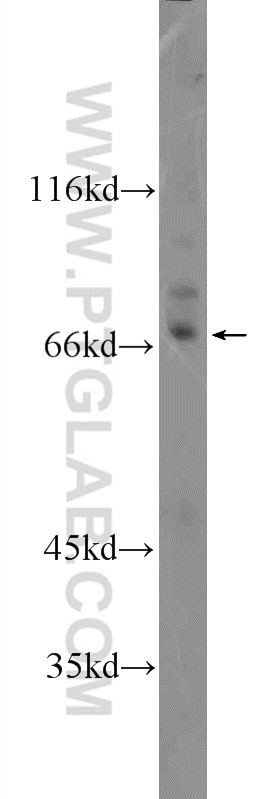 Western Blot (WB) analysis of mouse brain tissue using KLHL28 Polyclonal antibody (25224-1-AP)