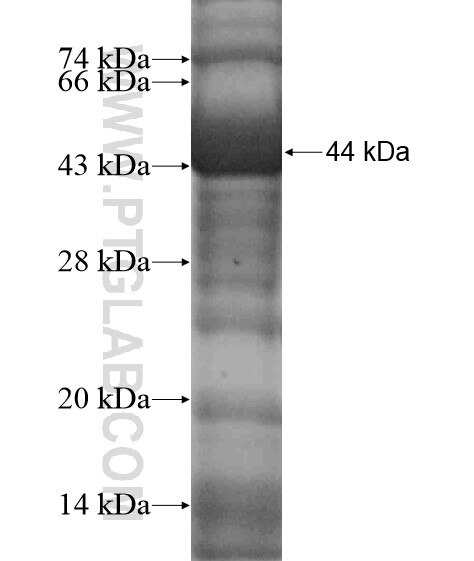 KLHL28 fusion protein Ag18665 SDS-PAGE