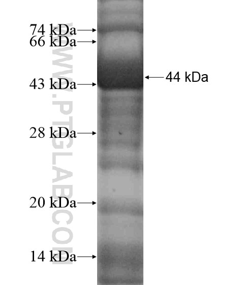 KLHL28 fusion protein Ag18665 SDS-PAGE