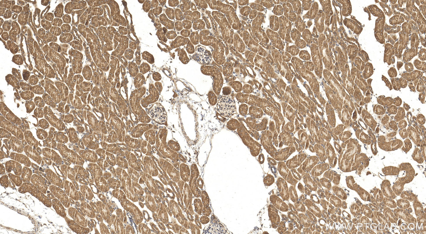 Immunohistochemistry (IHC) staining of mouse kidney tissue using KLHL29 Polyclonal antibody (20162-1-AP)