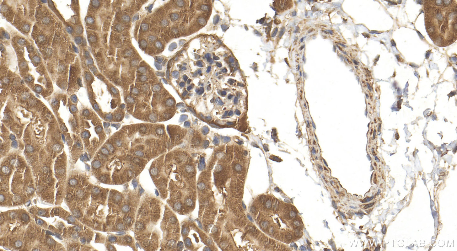 Immunohistochemistry (IHC) staining of mouse kidney tissue using KLHL29 Polyclonal antibody (20162-1-AP)