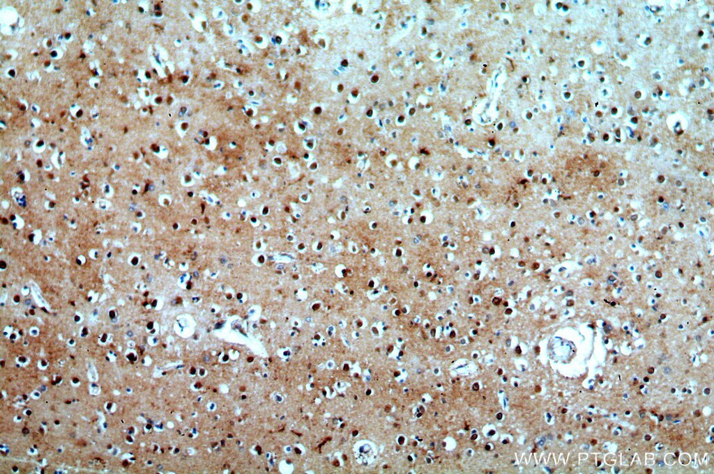 Immunohistochemistry (IHC) staining of human brain tissue using KLHL29 Polyclonal antibody (20162-1-AP)