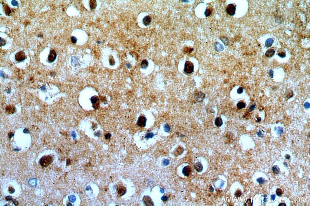 Immunohistochemistry (IHC) staining of human brain tissue using KLHL29 Polyclonal antibody (20162-1-AP)