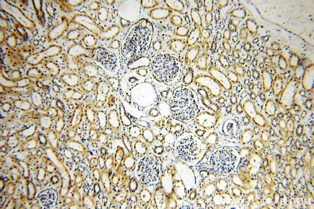Immunohistochemistry (IHC) staining of human kidney tissue using KLHL29 Polyclonal antibody (20162-1-AP)