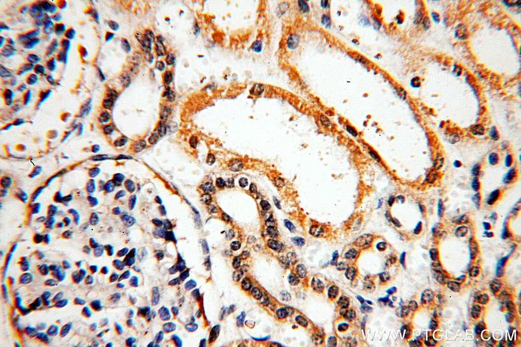 Immunohistochemistry (IHC) staining of human kidney tissue using KLHL29 Polyclonal antibody (20162-1-AP)