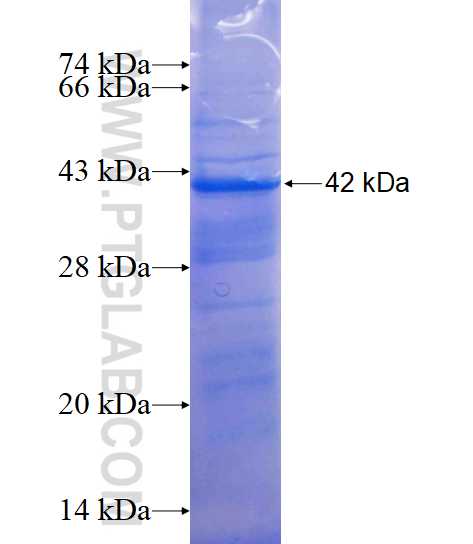 KLHL29 fusion protein Ag15102 SDS-PAGE