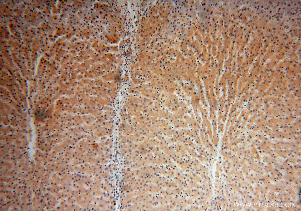 Immunohistochemistry (IHC) staining of human liver tissue using KLHL3 Polyclonal antibody (16951-1-AP)