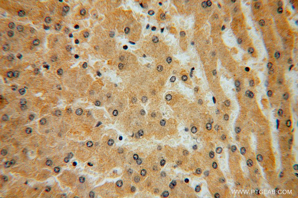 Immunohistochemistry (IHC) staining of human liver tissue using KLHL3 Polyclonal antibody (16951-1-AP)