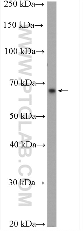 Western Blot (WB) analysis of mouse pancreas tissue using KLHL3 Polyclonal antibody (16951-1-AP)
