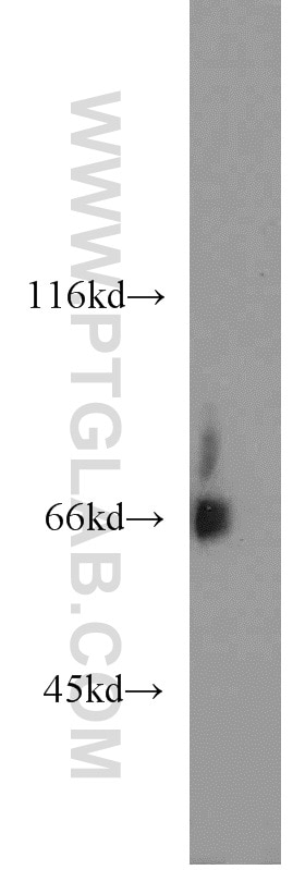 Western Blot (WB) analysis of mouse liver tissue using KLHL3 Polyclonal antibody (16951-1-AP)