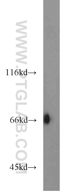 Western Blot (WB) analysis of Jurkat cells using KLHL3 Polyclonal antibody (16951-1-AP)