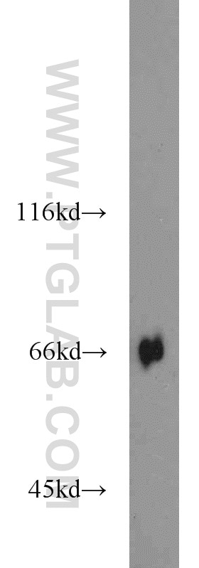 Western Blot (WB) analysis of HepG2 cells using KLHL3 Polyclonal antibody (16951-1-AP)