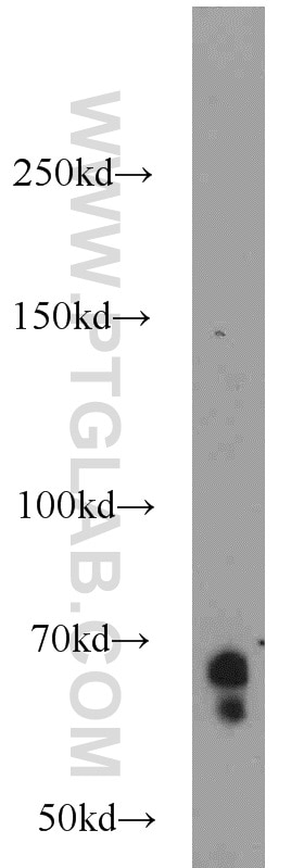 Western Blot (WB) analysis of rat liver tissue using KLHL3 Polyclonal antibody (16951-1-AP)