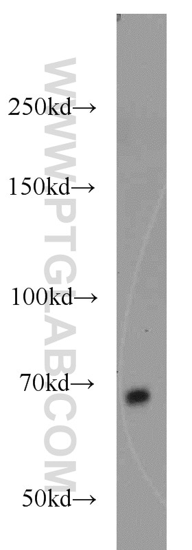 Western Blot (WB) analysis of HepG2 cells using KLHL3 Polyclonal antibody (16951-1-AP)