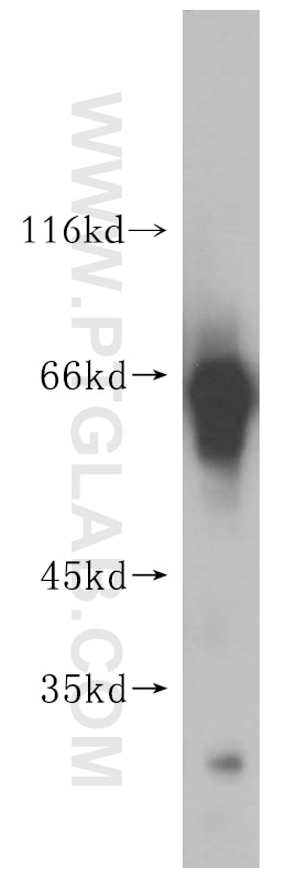 Western Blot (WB) analysis of human liver tissue using KLHL3 Polyclonal antibody (16951-1-AP)