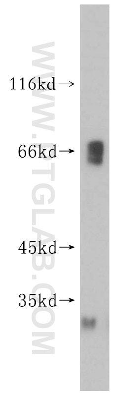 Western Blot (WB) analysis of mouse thymus tissue using KLHL3 Polyclonal antibody (16951-1-AP)