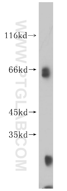 Western Blot (WB) analysis of HL-60 cells using KLHL3 Polyclonal antibody (16951-1-AP)