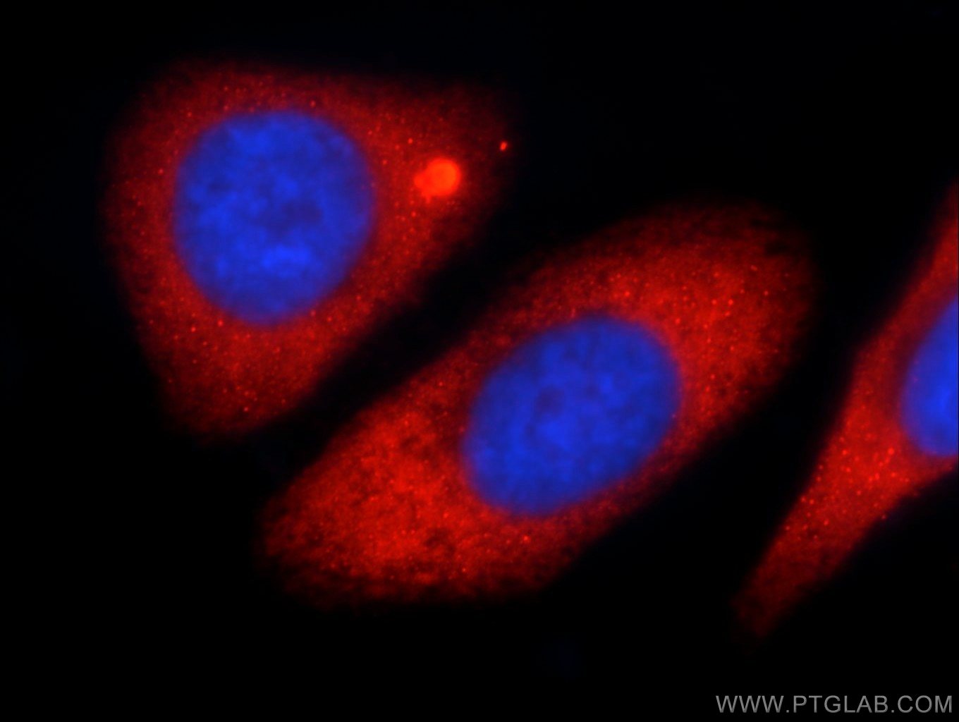 Immunofluorescence (IF) / fluorescent staining of HepG2 cells using KLHL31 Polyclonal antibody (24781-1-AP)