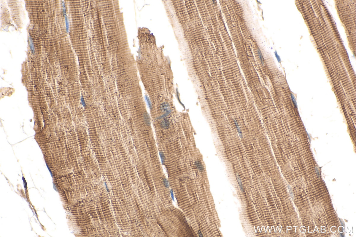 Immunohistochemistry (IHC) staining of mouse skeletal muscle tissue using KLHL31 Polyclonal antibody (24781-1-AP)