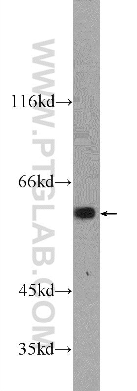 Western Blot (WB) analysis of mouse embryo tissue using KLHL31 Polyclonal antibody (24781-1-AP)