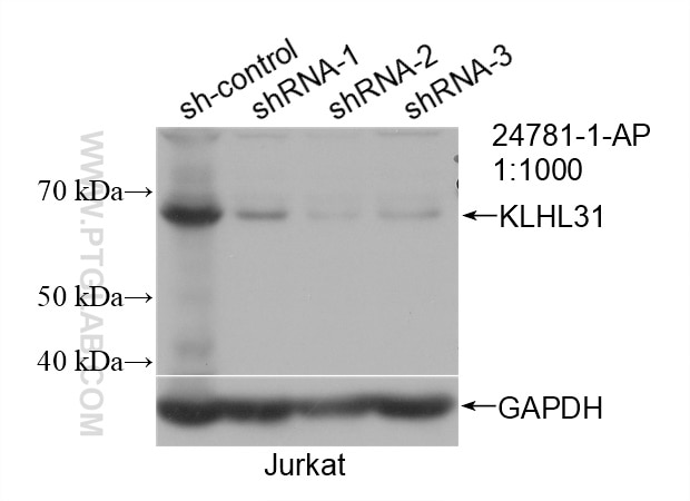 Western Blot (WB) analysis of Jurkat cells using KLHL31 Polyclonal antibody (24781-1-AP)