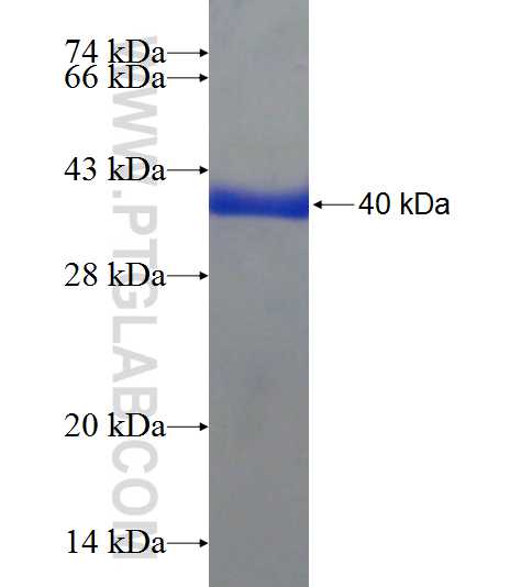 KLHL31 fusion protein Ag20462 SDS-PAGE