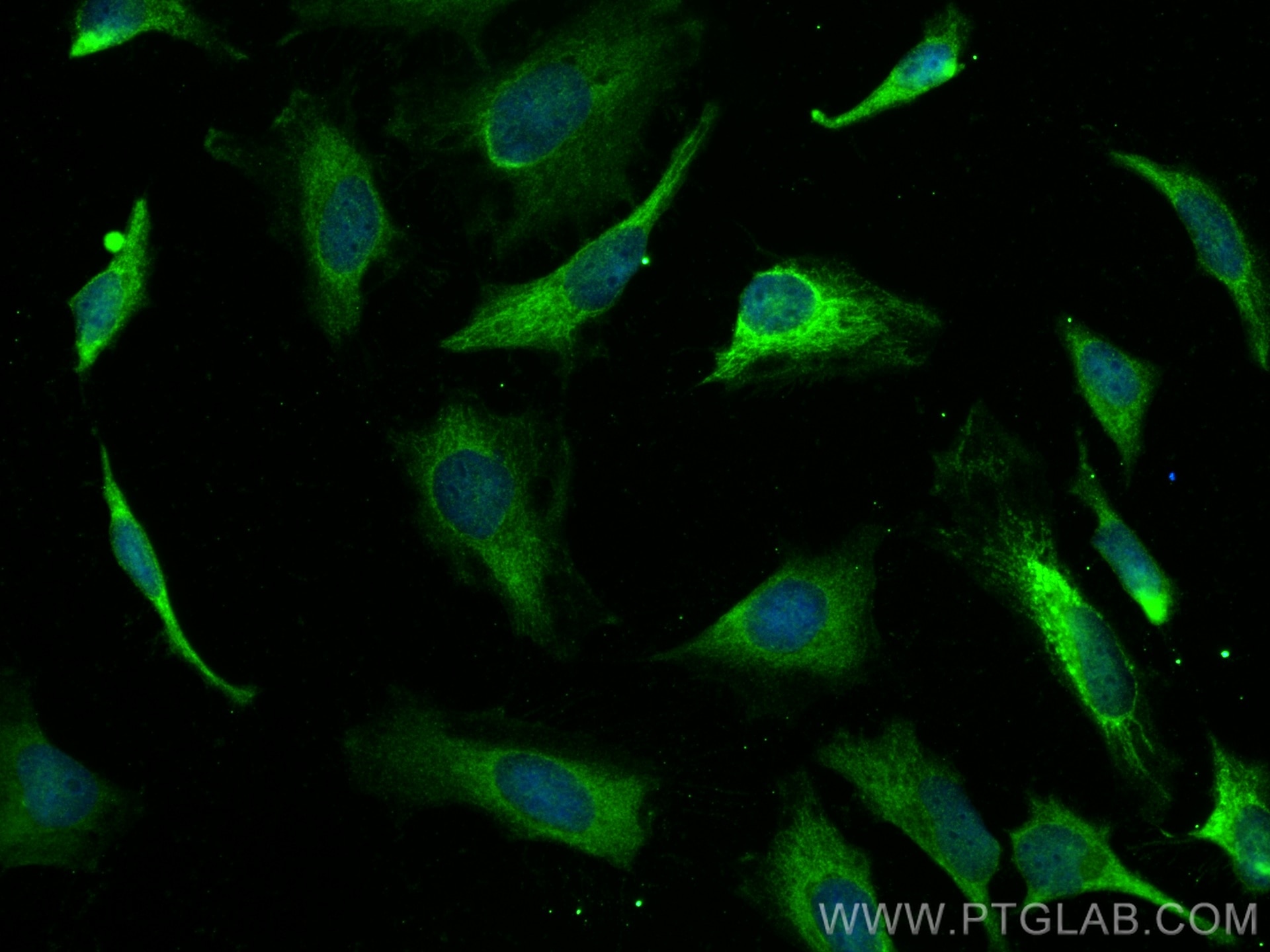 Immunofluorescence (IF) / fluorescent staining of HeLa cells using KLHL32 Polyclonal antibody (17775-1-AP)