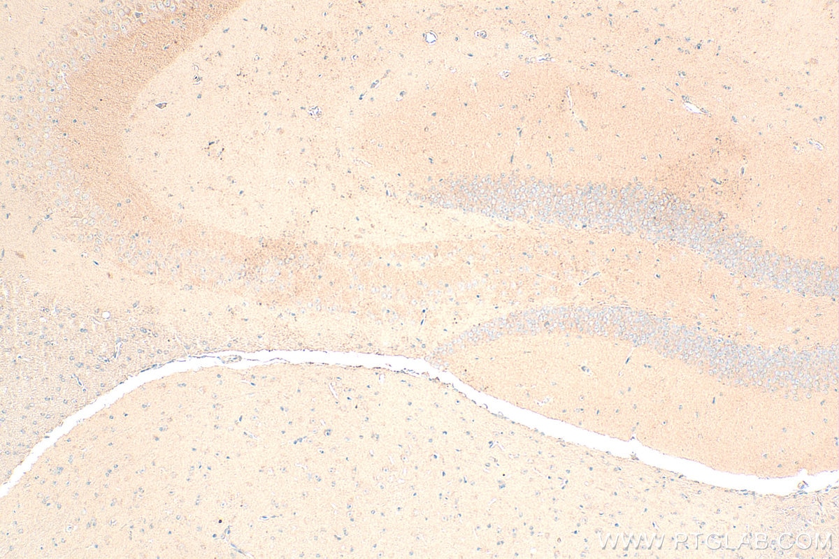 IHC staining of mouse brain using 28621-1-AP (same clone as 28621-1-PBS) Immunohistochemistry (IHC) staining of mouse brain tissue using KLHL32 Polyclonal antibody (28621-1-AP)